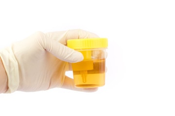 A gloved hand holding a container with a liquid sample.